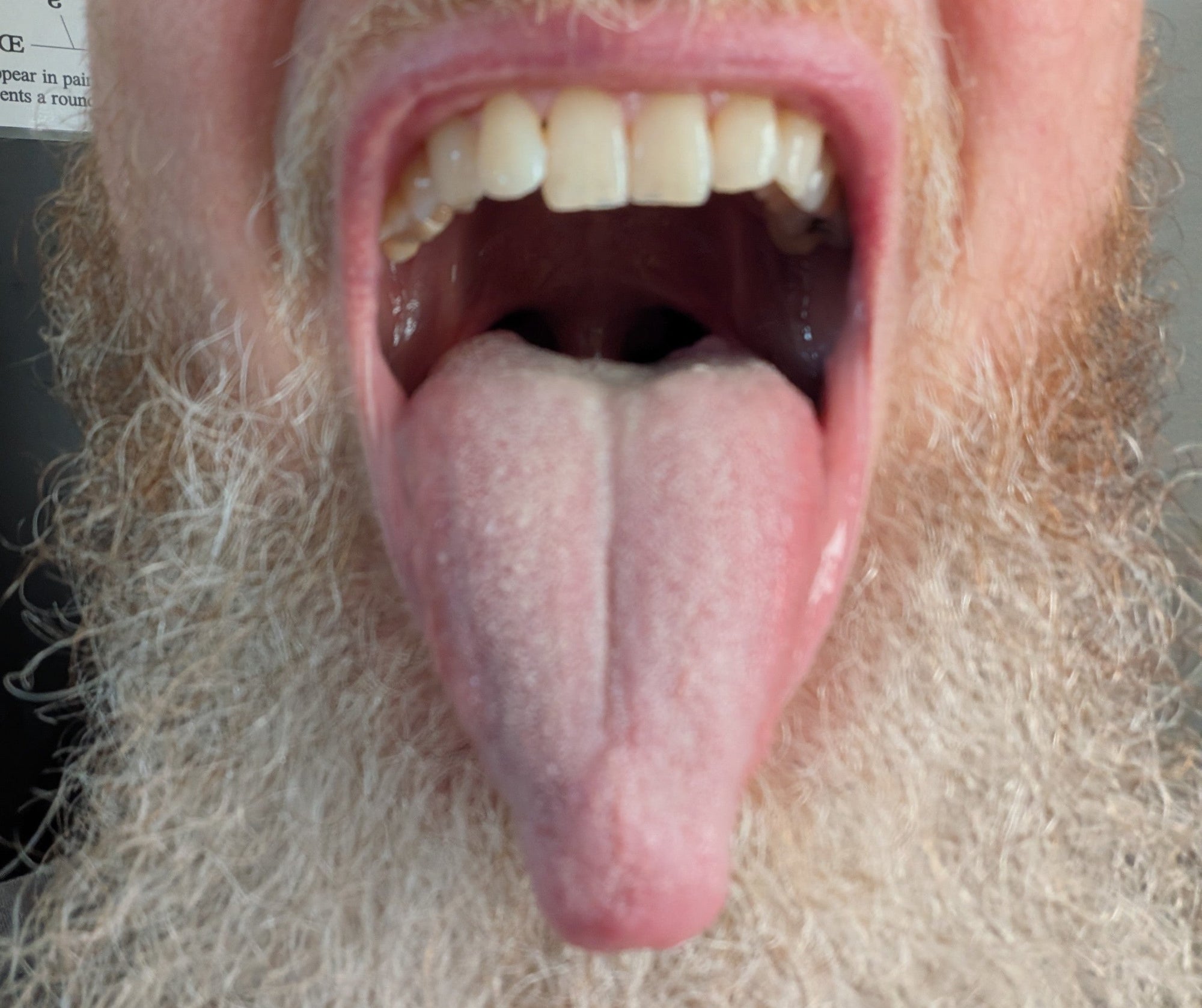 Tongue Stretch to Open the Throat
