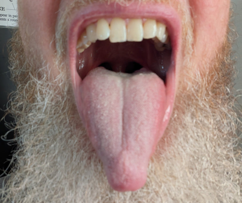 Tongue Stretch to Open the Throat